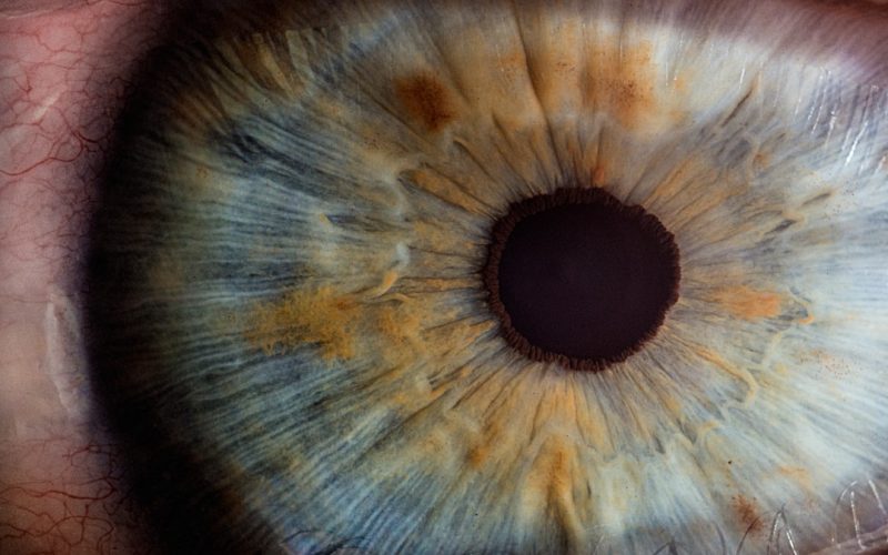 Photo eye examination